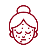 REDUCE APPEARANCE OF SCARS