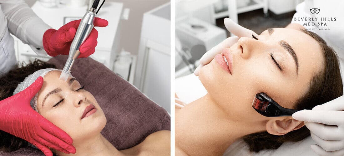 Microneedling vs Dermarolling: Which is Good For You?