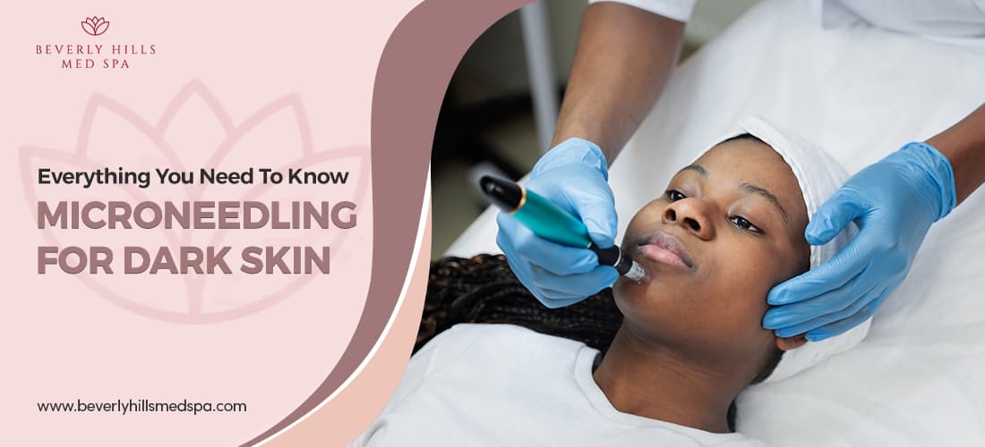 Microneedling for Dark Skin